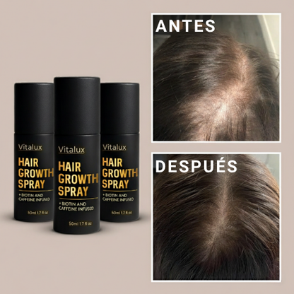 Cabello más grueso y saludable con Vitalux